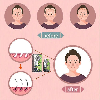 Ginger Plant Extract anti - hair loss shampoo ( Pack Of 10 )