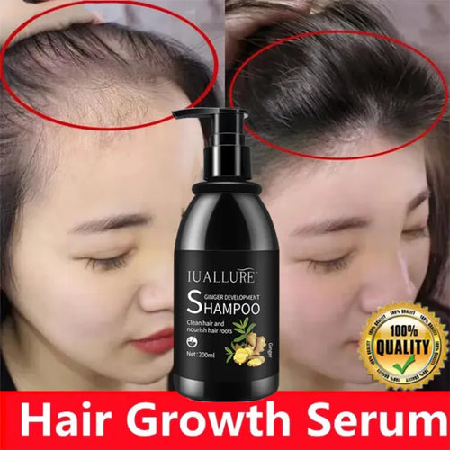 IUALLURE™ Ginger Development Shampoo ( BUY 1 GET 1 FREE )