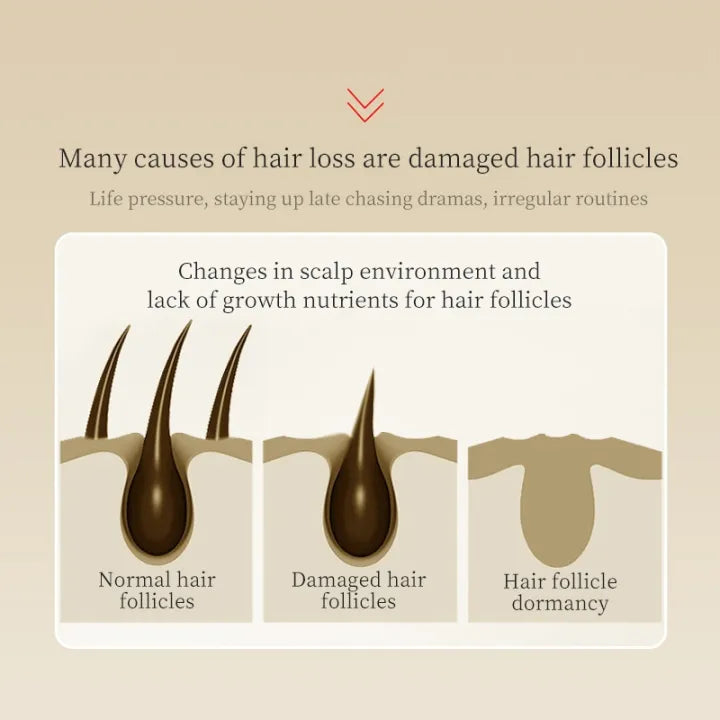 LiQT Anti–Hair Growth Ginger Shampoo ( BUY 1 GET 1 FREE )