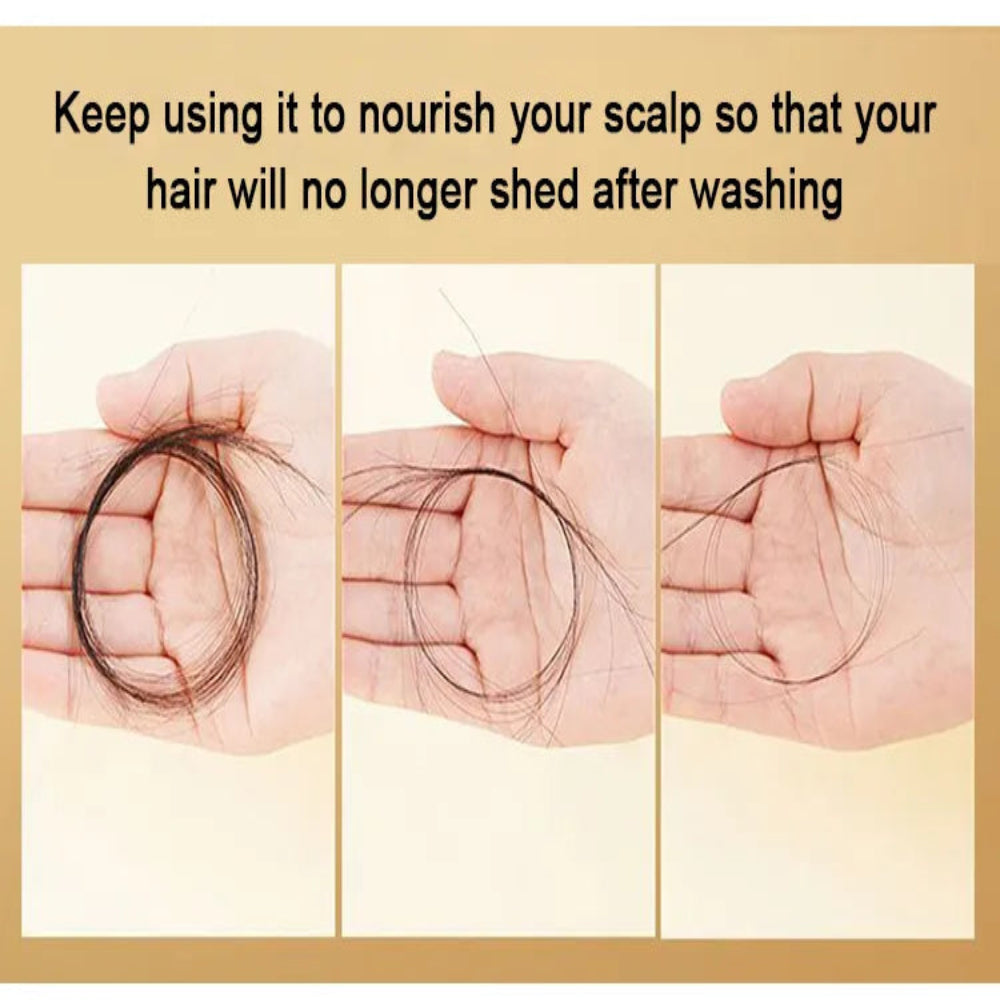 King Of Ginger Anti-Hair Loss Shampoo ( BUY 1 GET 1 FREE )