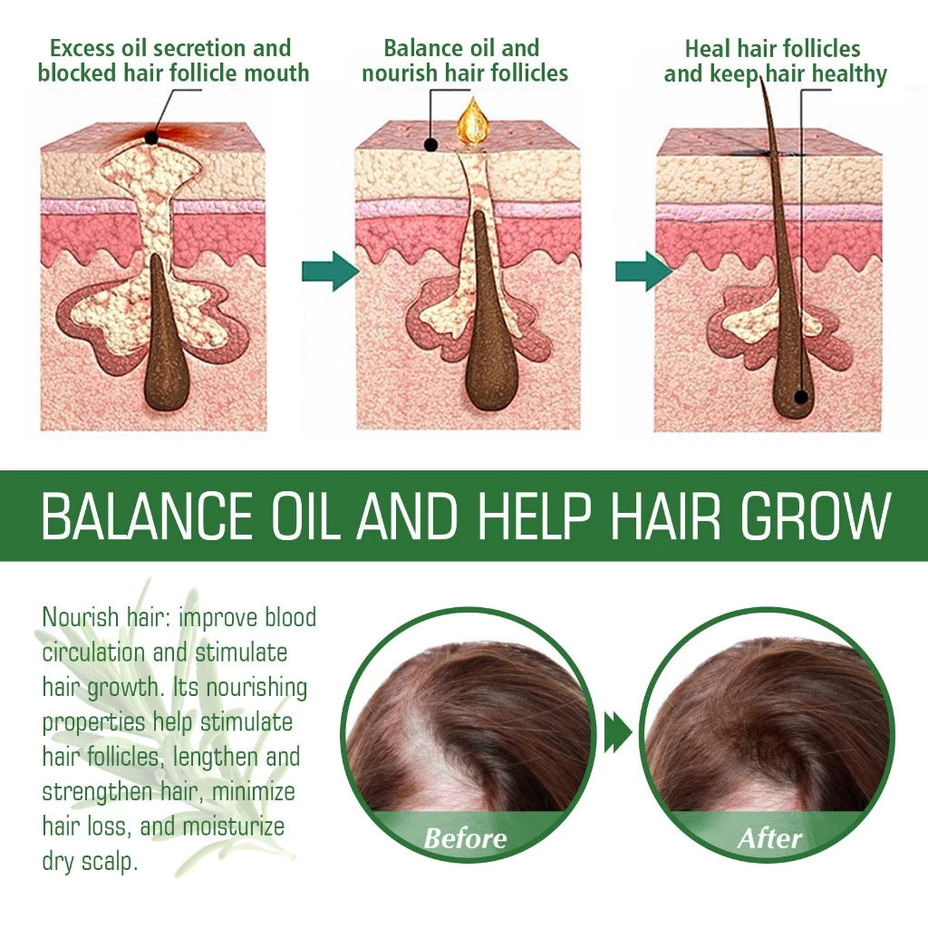 Rosemary Hair , Skin & body  Essentiall Oil  ( BUY 1 GET 1 FREE )