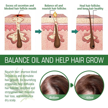 Rosemary Hair , Skin & body  Essentiall Oil  ( BUY 1 GET 1 FREE )
