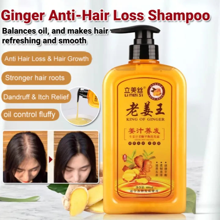 King Of Ginger Anti-Hair Loss Shampoo ( BUY 1 GET 1 FREE )