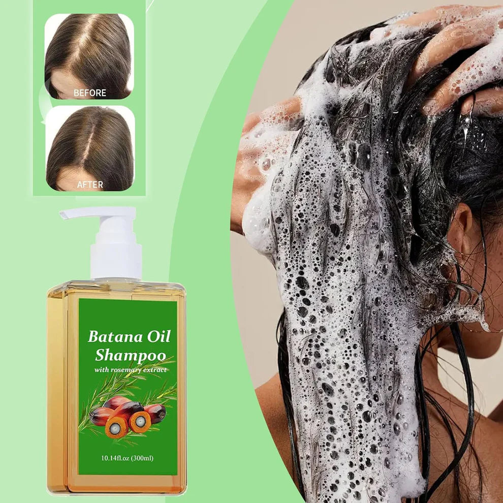 Batana Oil Shampoo for Hair Growth with Rosemary Extract🌱✨