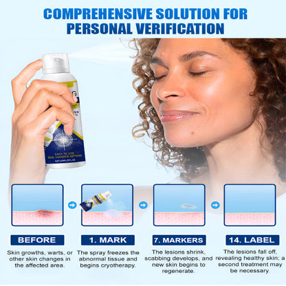 LANISKA Wart Care Topical Spray