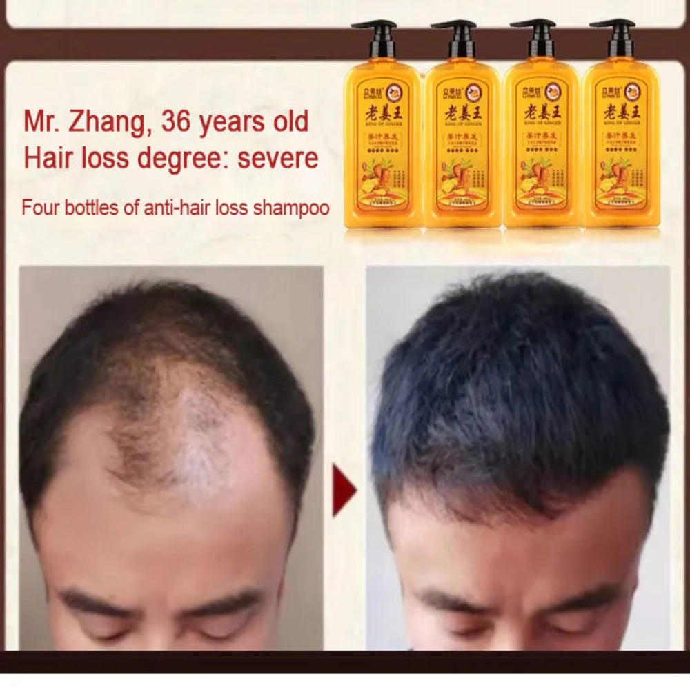 King Of Ginger Anti-Hair Loss Shampoo ( BUY 1 GET 1 FREE )