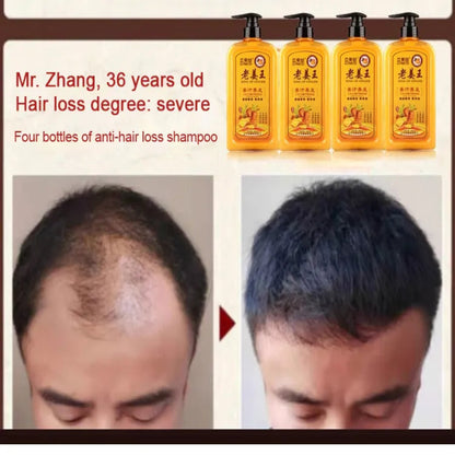 King Of Ginger Anti-Hair Loss Shampoo ( BUY 1 GET 1 FREE )
