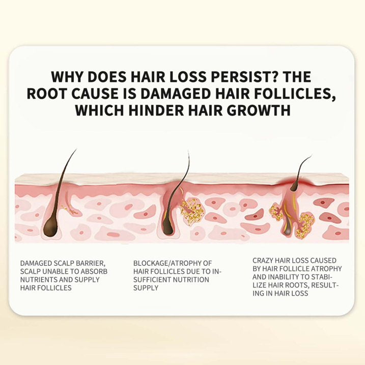 Ginger Plant Extract anti - hair loss shampoo ( Pack Of 10 )