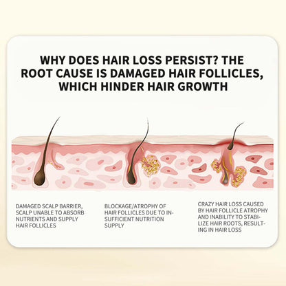 Ginger Plant Extract anti - hair loss shampoo ( Pack Of 10 )