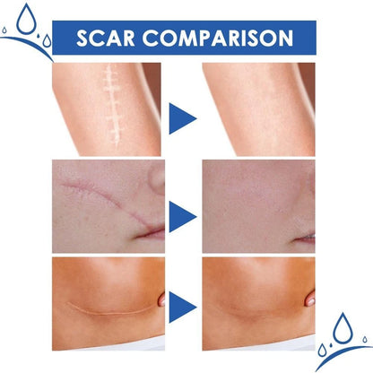 JAYSUING™ Scar Removal Cream ( BUY 1 GET 1 FREE )