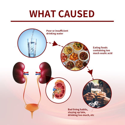 💧🌿 SouthMoon™ Renal Stone Patch ( BUY 1 GET 1 FREE )