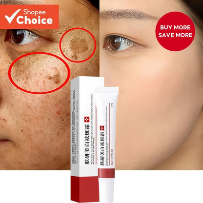 🌺🌙 GlowFade Radiance Repair Cream – Freckle, Pigmentation & Acne Scar Solution 🌸💧