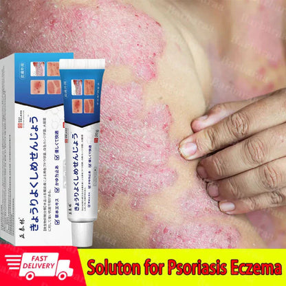 Japan Anti - Fungal Ointment Eczema Cream ( BUY 1 GET 1 FREE )