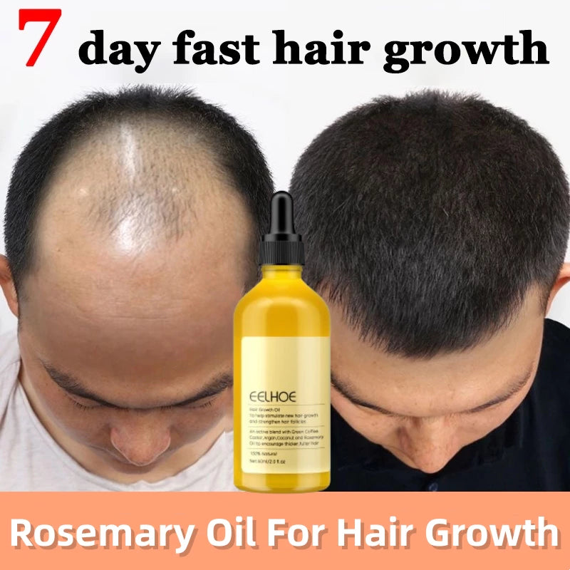 Imported Rosemary Hair Growth Oil ( BUY 1 GET 1 FREE )