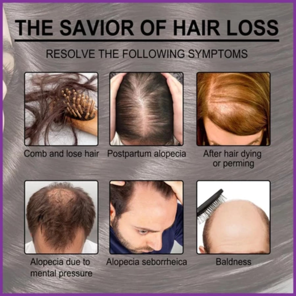 Rosemary Hair , Skin & body  Essentiall Oil  ( BUY 1 GET 1 FREE )